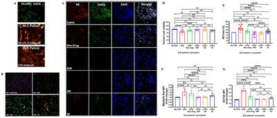 Dexamethasone and IFN-γ primed mesenchymal stem cells conditioned media immunomodulates aberrant NETosis in SLE via PGE2 and IDO